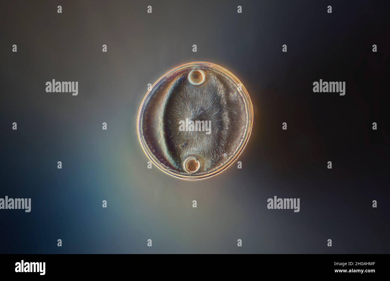 Auliscus diatom, illuminazione fase-campo scuro Foto Stock