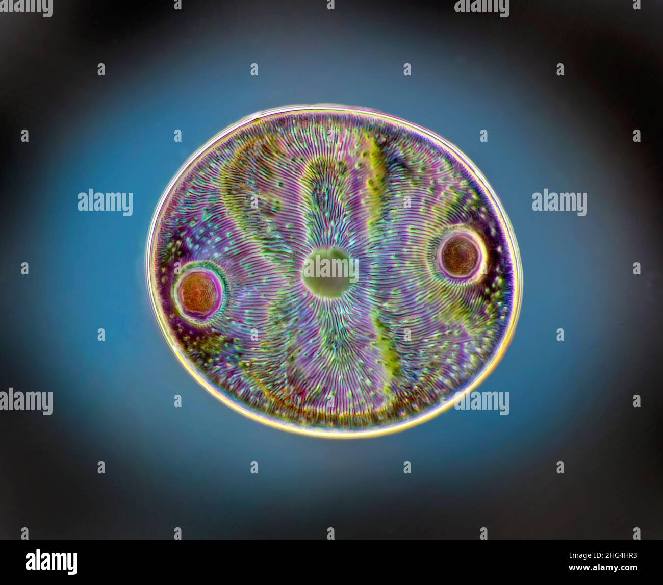 Auliscus diatom, illuminazione fase-campo scuro Foto Stock