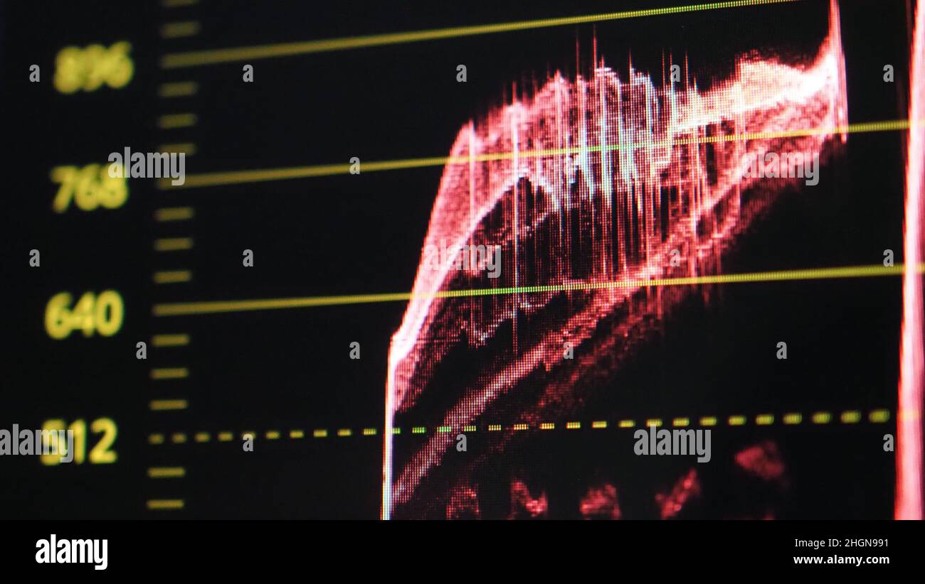 Grafico di classificazione del colore o indicatore di correzione del colore RGB sul monitor durante il processo di post-produzione. Fase di telecine nell'elaborazione della produzione di video o film. f Foto Stock