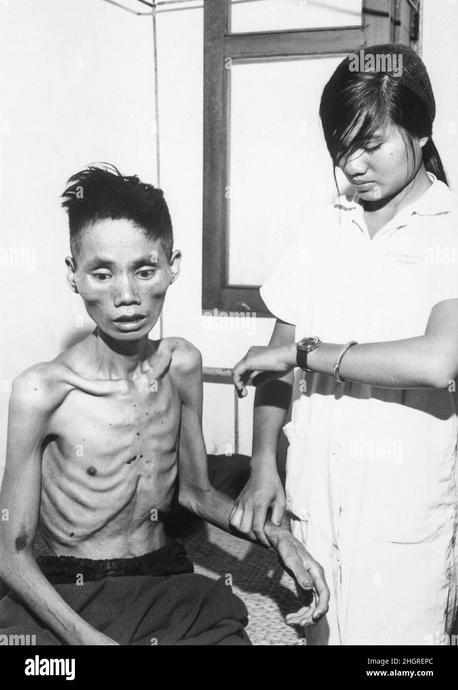 Un'infermiera che prende i segni vitali di un uomo vietnamita affamato Foto Stock