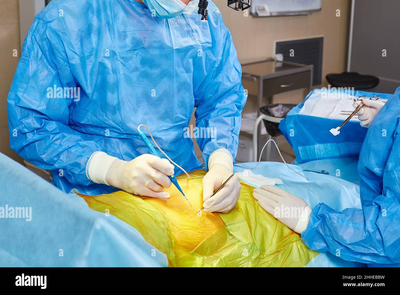 Il team medico di chirurghi in ospedale facendo minimamente invasivo di interventi chirurgici. La chirurgia sala operatoria con apparecchiature di elettrocauterizzazione per cardiovas Foto Stock