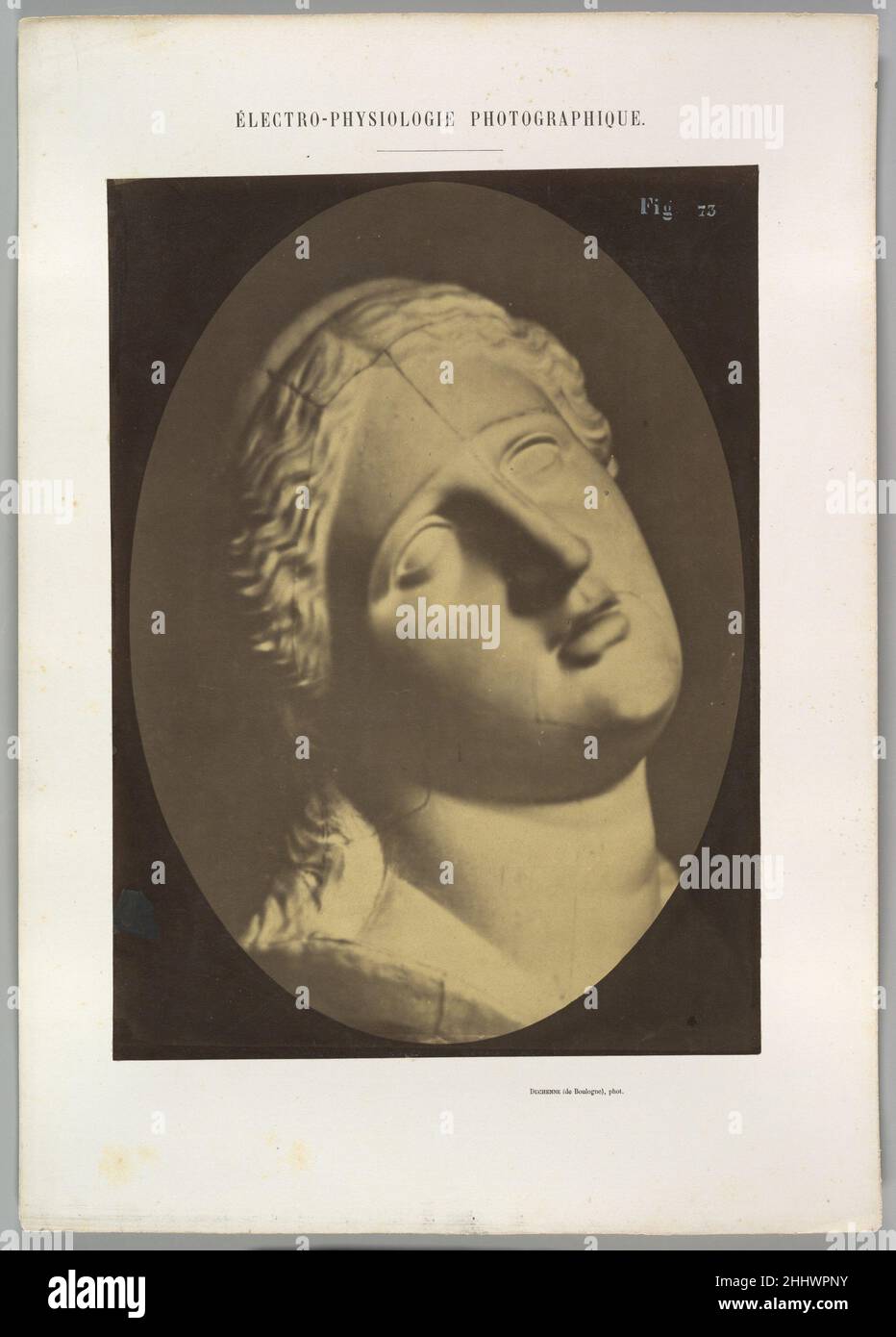 Figura 73: Testa di Niobe 1854–56, stampato 1862 Guillaume-Benjamin-Amand Duchenne de Boulogne Francese. Figura 73: Testa di Niobe 623066 Foto Stock