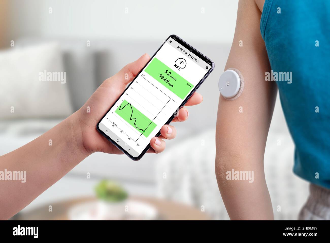 Misurazione della glicemia con l'ausilio di app mobile e sensore. La mano avvicina il telefono al sensore posto sul concetto di mano del bambino Foto Stock