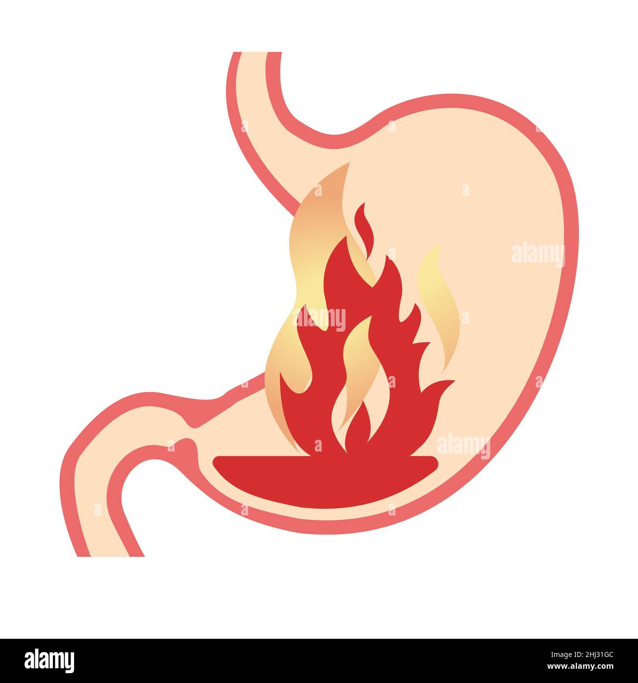 Acidità dello stomaco - immagine dell'icona di sensazione di busrning come file EPS 10 Illustrazione Vettoriale