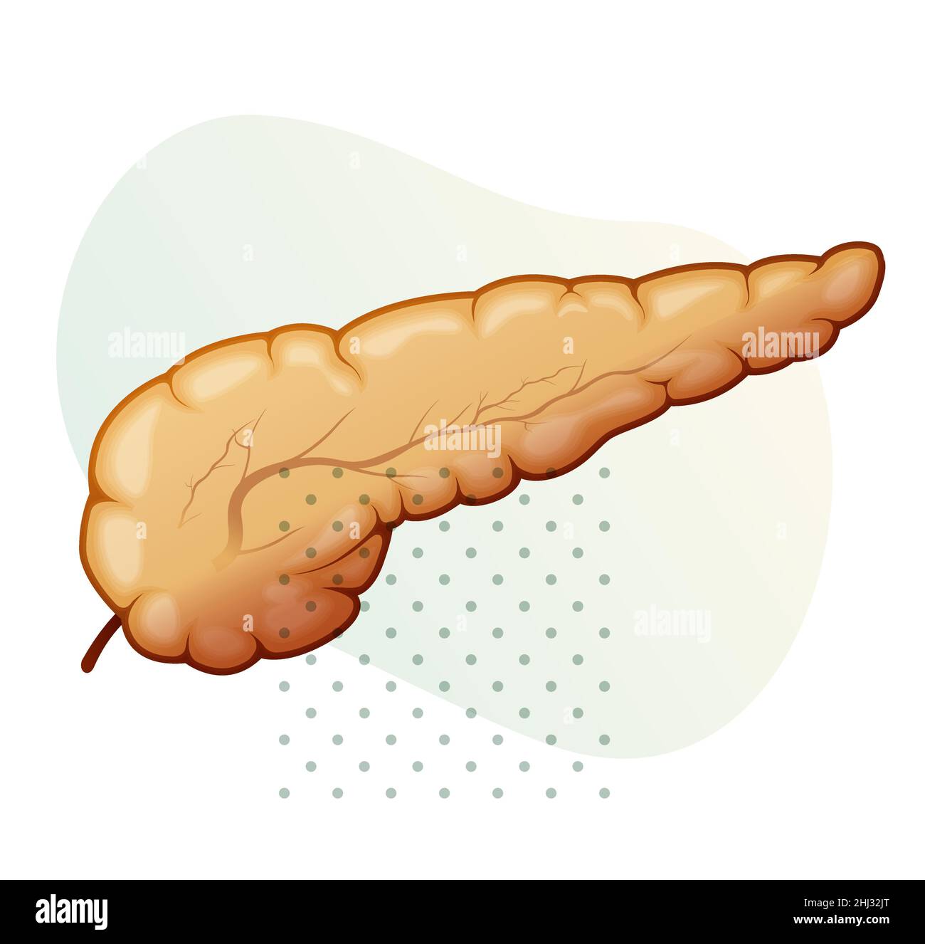 Pancreas - pancreatite acuta - Stock Illustration as EPS 10 file Illustrazione Vettoriale