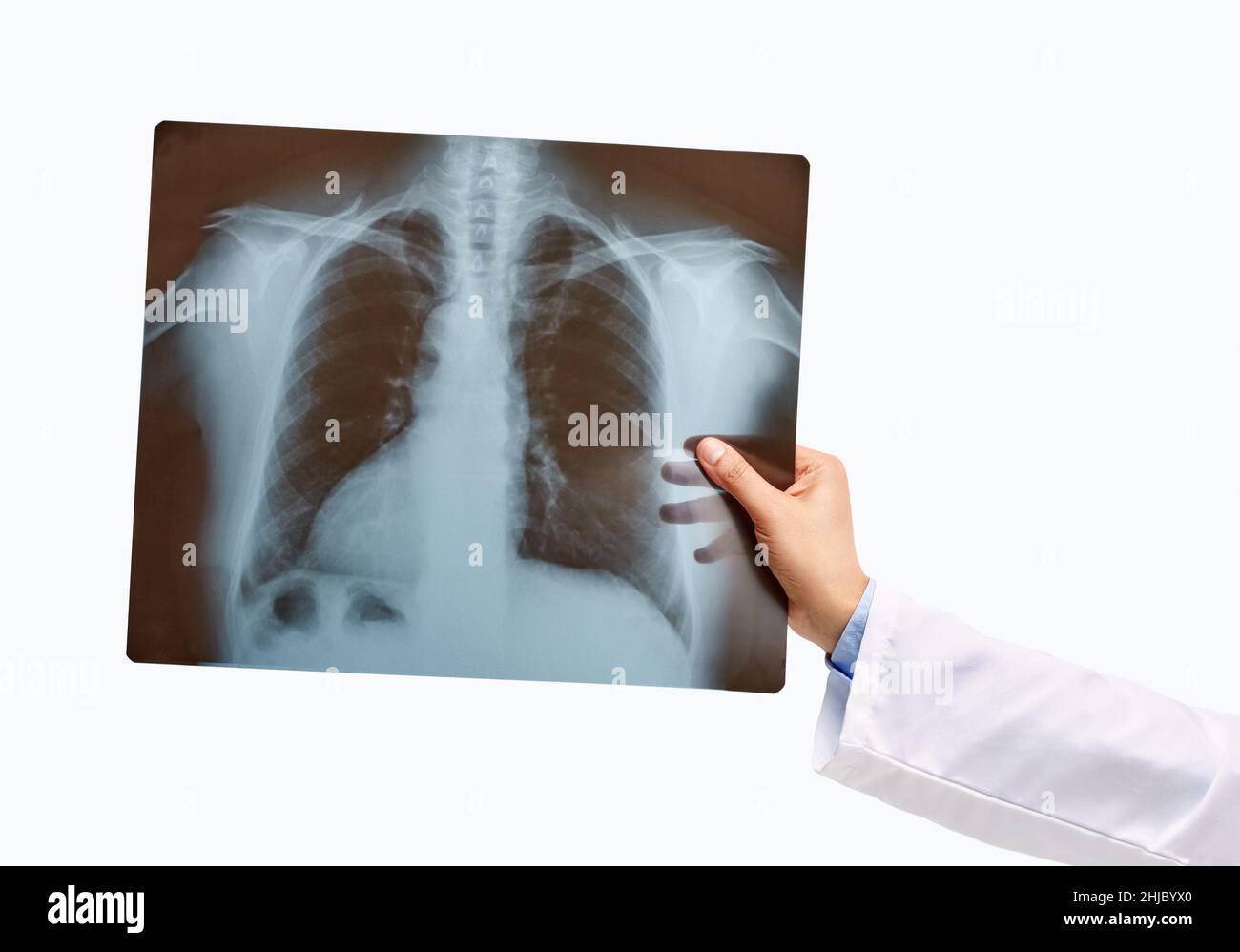 Mano dell'uomo che tiene una radiografia dei polmoni isolata su uno sfondo bianco Foto Stock