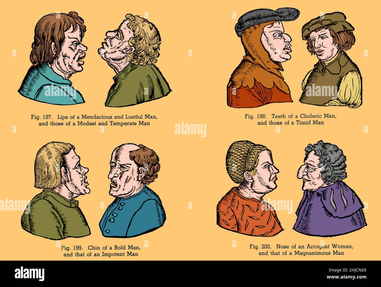 Illustrazioni di stereotipi medievali di personalità basate su caratteristiche facciali. La pseudoscienza della fisiognomia è la valutazione del carattere o della personalità di una persona dal suo aspetto esterno, specialmente il volto. Colore ottimizzato. Foto Stock