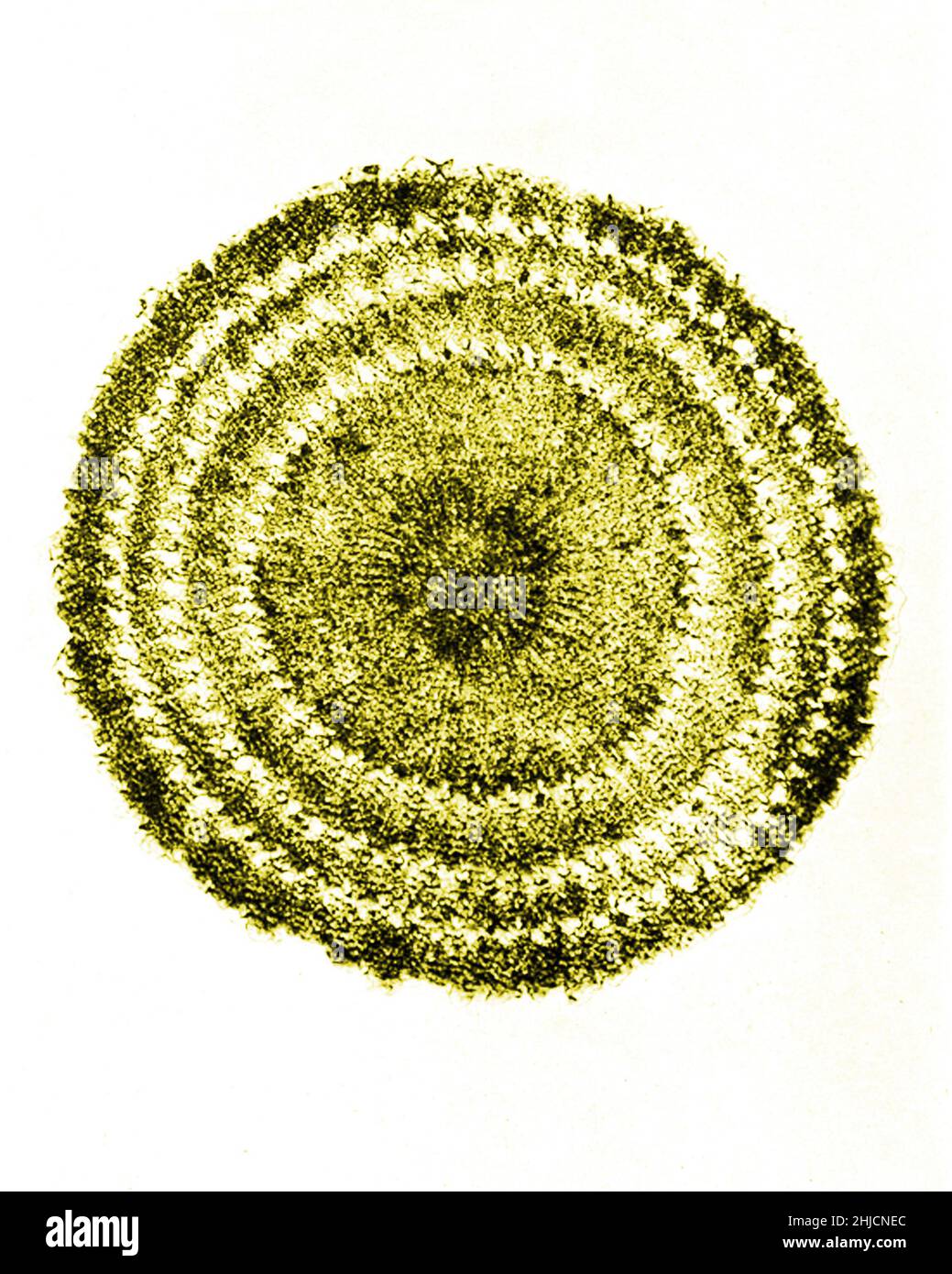 Sezione della colonna vertebrale echinus (riccio di mare). Ingrandimento: 60x. Fotomicrografia realizzata da Arthur e Smith all'inizio del 1900s, utilizzando un microscopio e una fotocamera combinati. Nel 1904, la Royal Society di Londra ha esposto al pubblico una serie di fotomicrografie di Smith. In seguito sono stati pubblicati nel 1909 in un libro intitolato "Nature Through Microscope & Camera". Sono stati i primi esempi di fotomicroscopia che molti avevano mai visto. Foto Stock