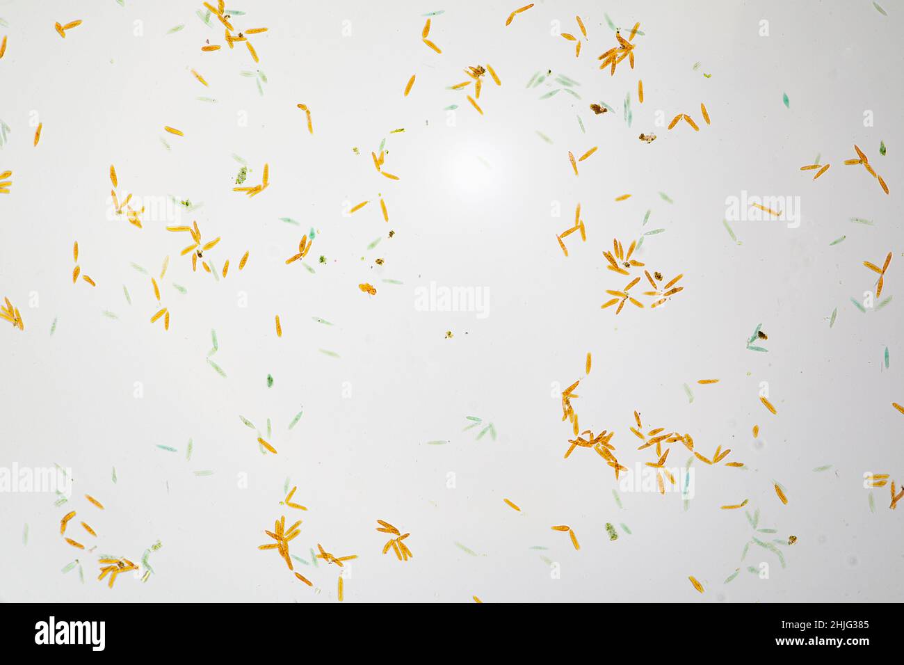 Euglena visto al microscopio ottico Foto Stock