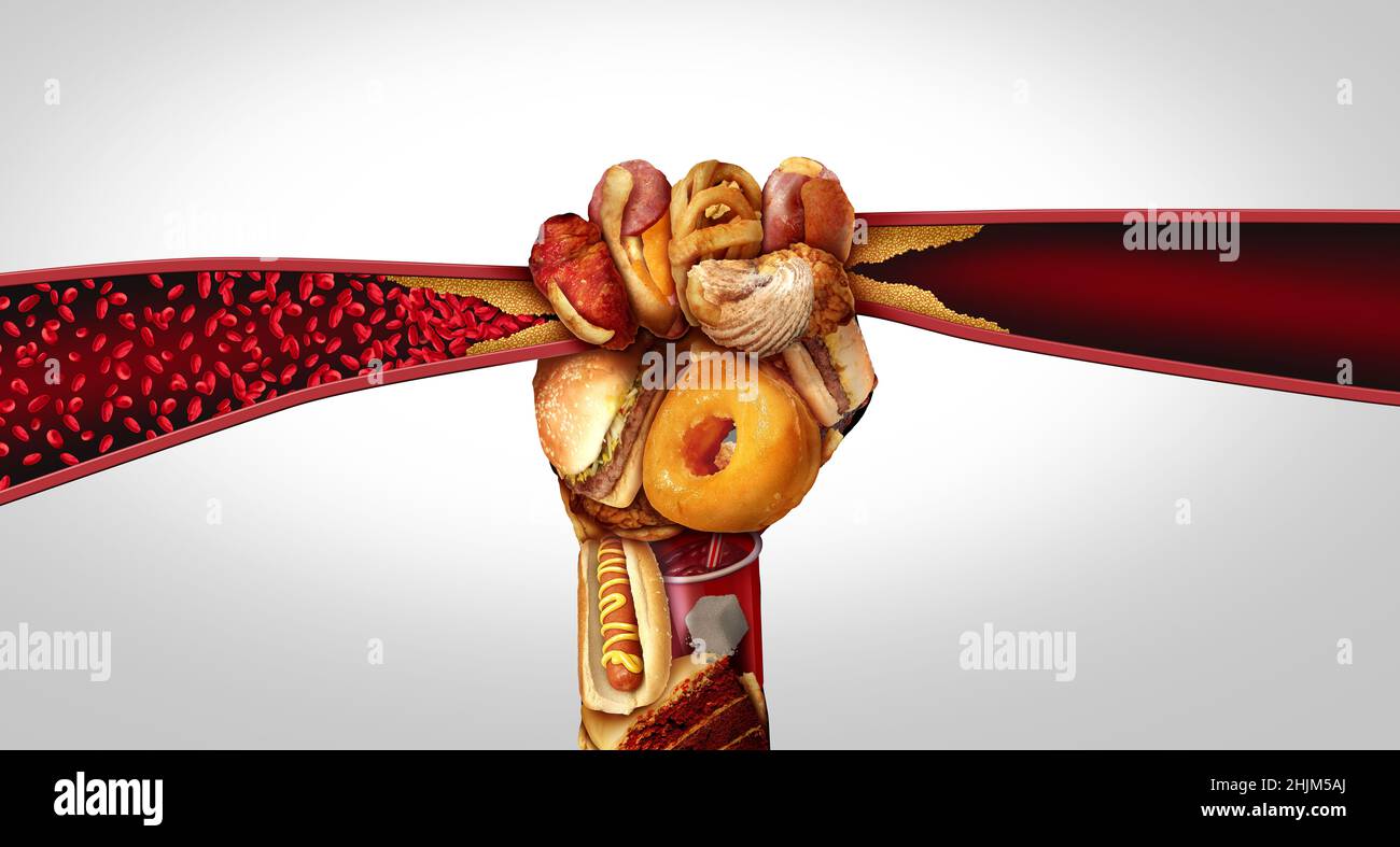 Arteriopatia e cibo che causano arteriosclerosi o arterie ostruite o vena umana come pugno di mano con grassi fast food che causano restringimento. Foto Stock