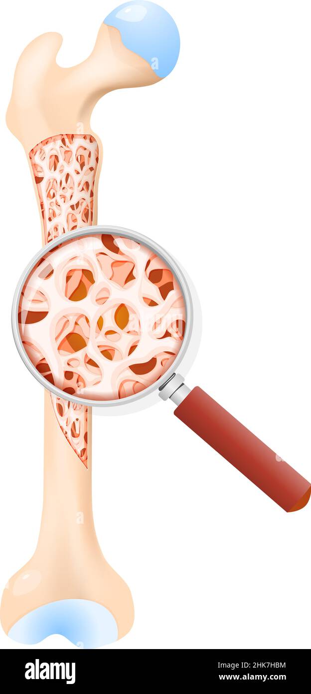 densità di un osso sano. Sezione trasversale del femore umano. All'interno di un osso che mostra la struttura trabecolare. Primo piano del tessuto osseo. Illustrazione Vettoriale