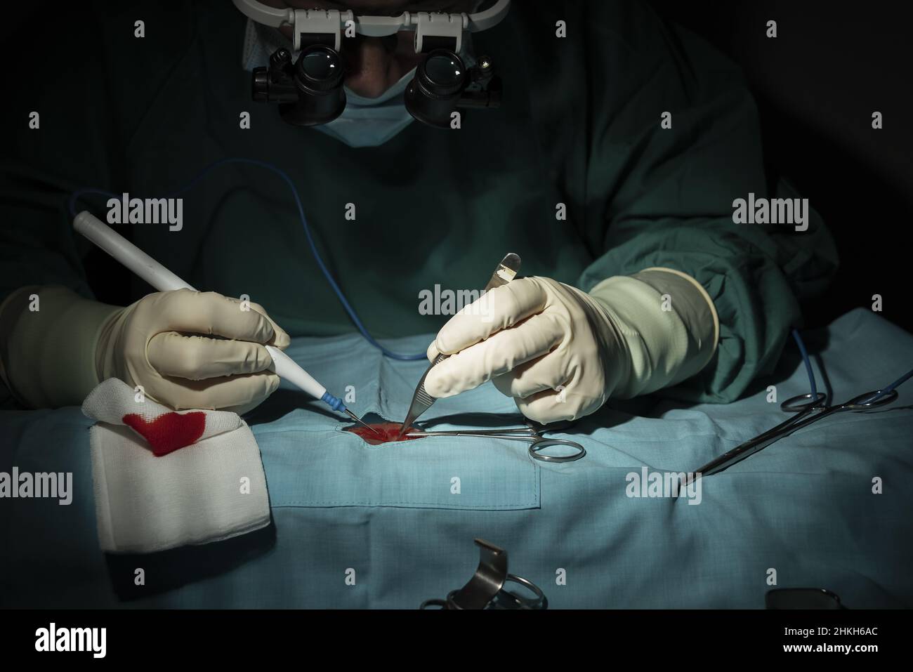 La chirurgo femminile esegue un intervento microchirurgico su un braccio. Foto Stock