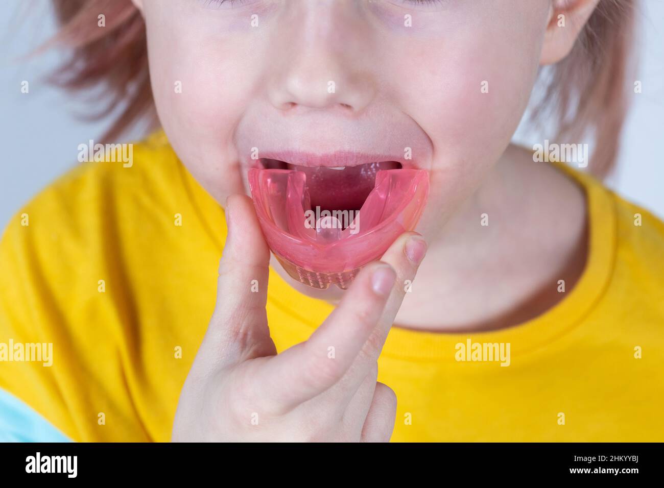 Adorabile bambina mette l'addestratore di miofunctional nella bocca. Tariner dentale è fatto per contribuire ad equalizzare i denti crescenti e morso corretto e t corretto Foto Stock