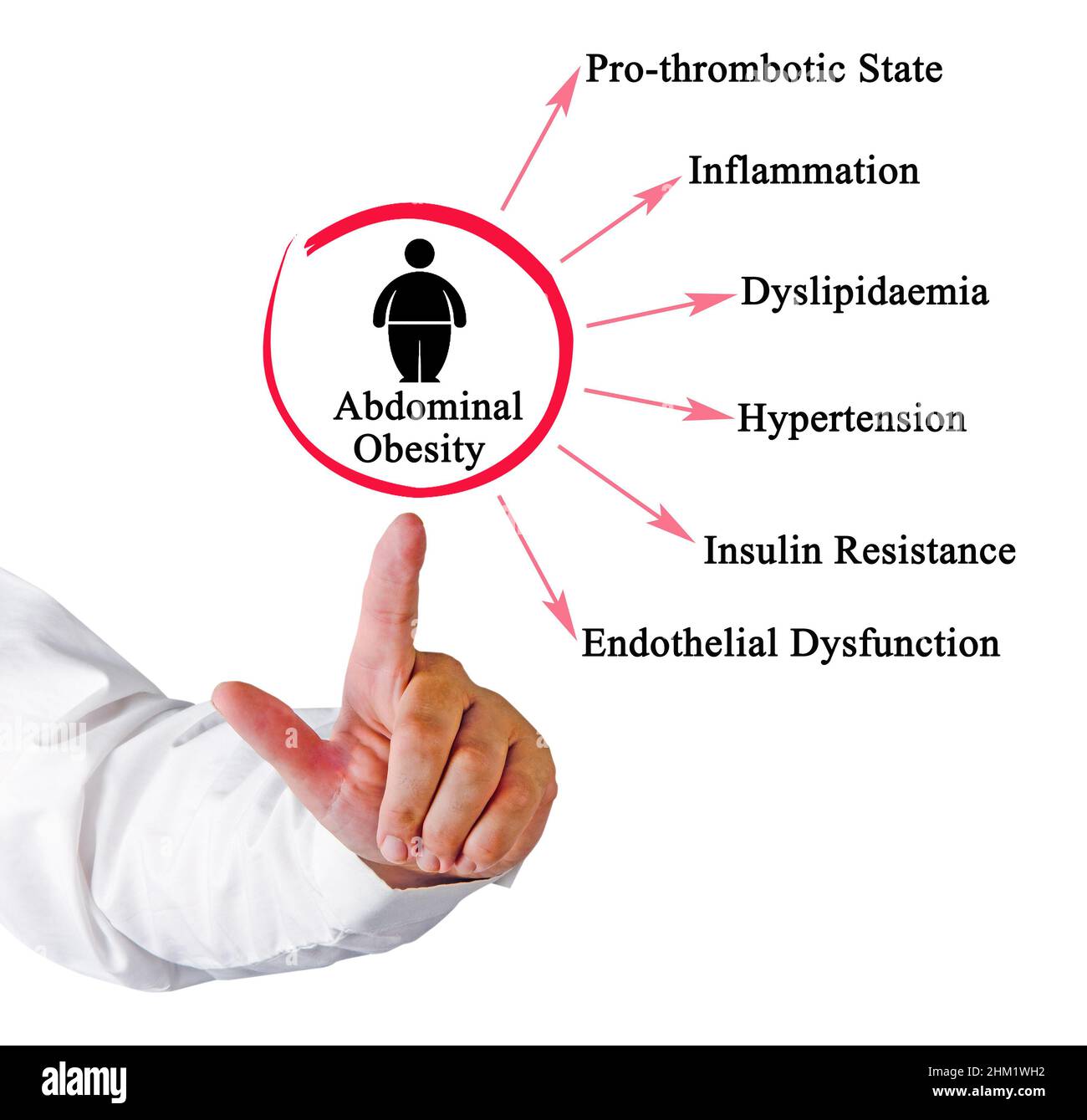Sei pericoli di obesità addominale Foto Stock