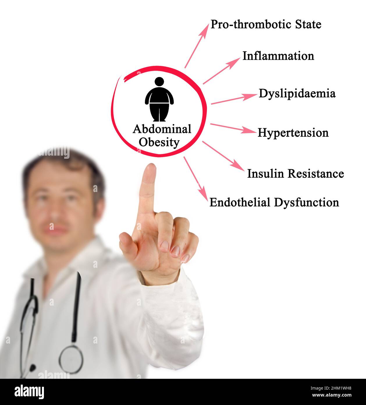 Sei pericoli di obesità addominale Foto Stock