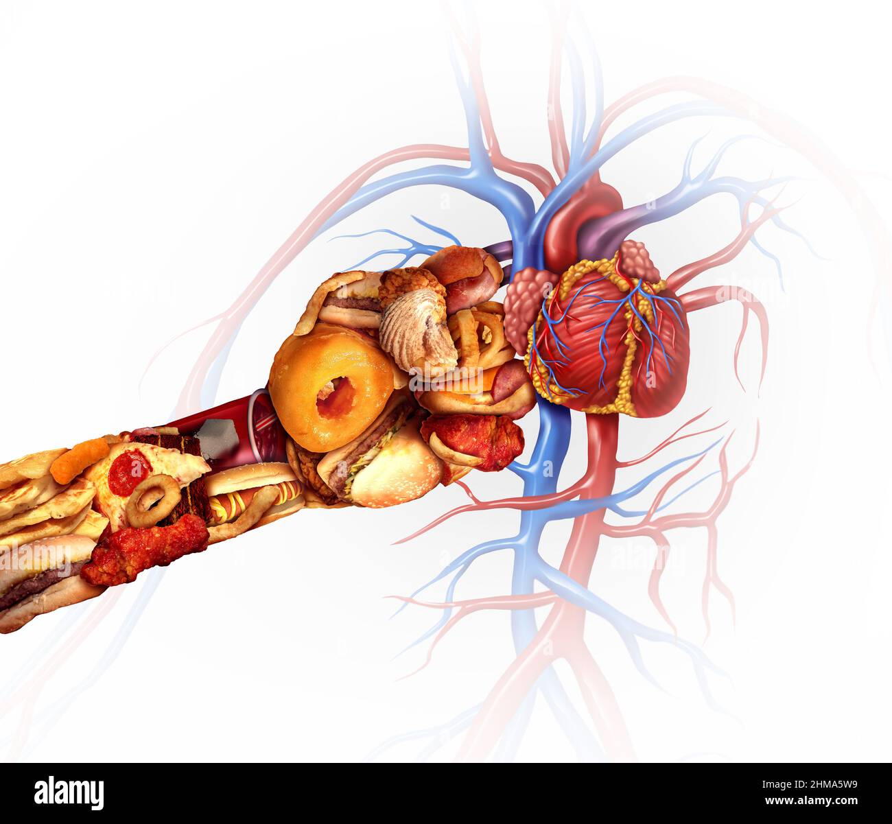 Attacco di cuore e dieta o malattia coronarica simbolo di rischio come un cattivo concetto di nutrizione con un organo cardiovascolare punched da grasso alto sale malsano. Foto Stock