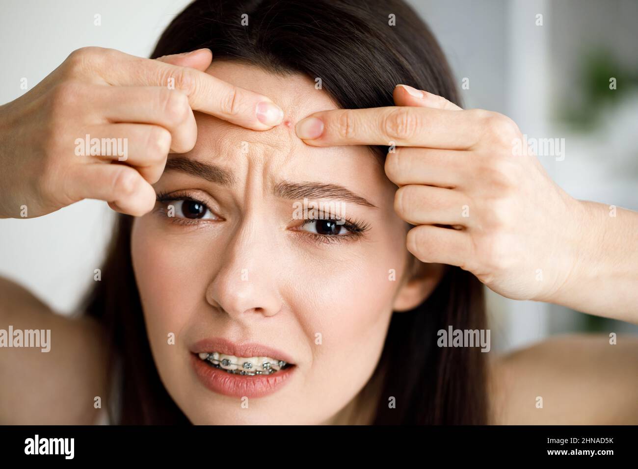 Una donna schiaccia un pimple mentre guarda nello specchio. Foto Stock