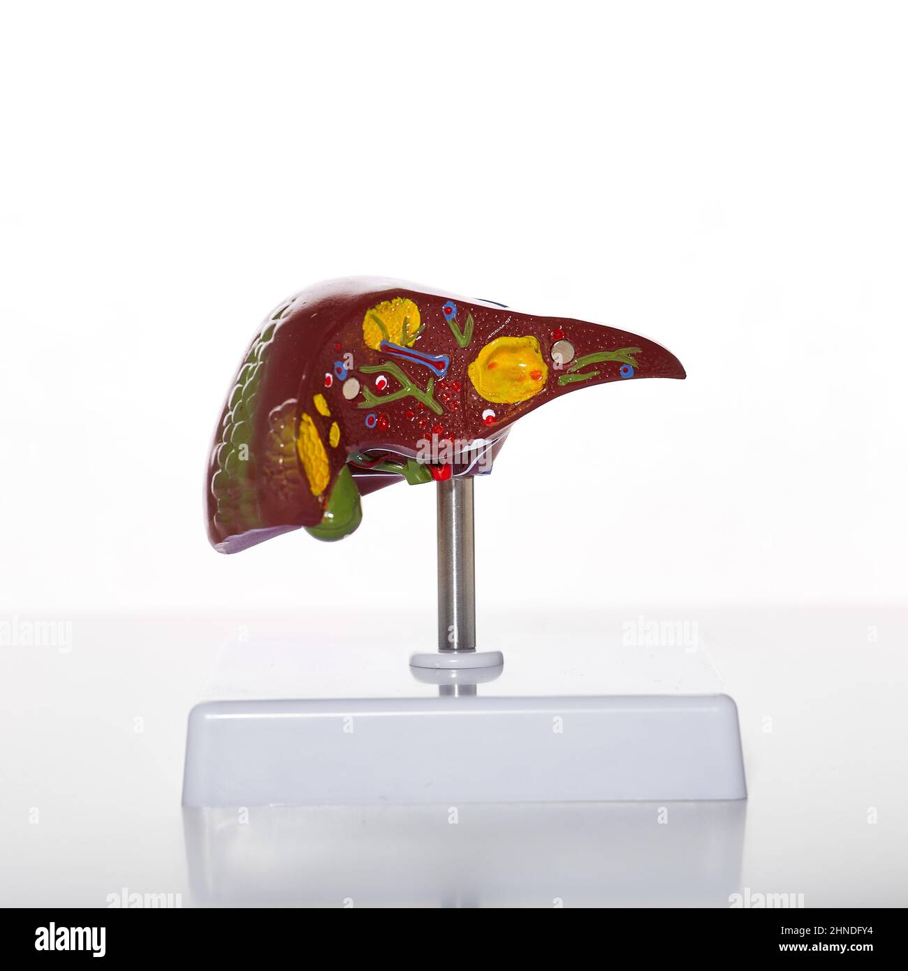 Modello anatomico visivo del fegato umano che mostra patologie epatiche e malattie, epatite, cirrosi e cancro per l'educazione medica, primo piano Foto Stock