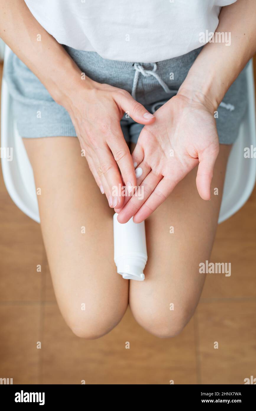 La ragazza tiene un vaso di crema di lividi nelle sue mani. La ragazza spalma la crema sulle mani. Vista dall'alto Foto Stock