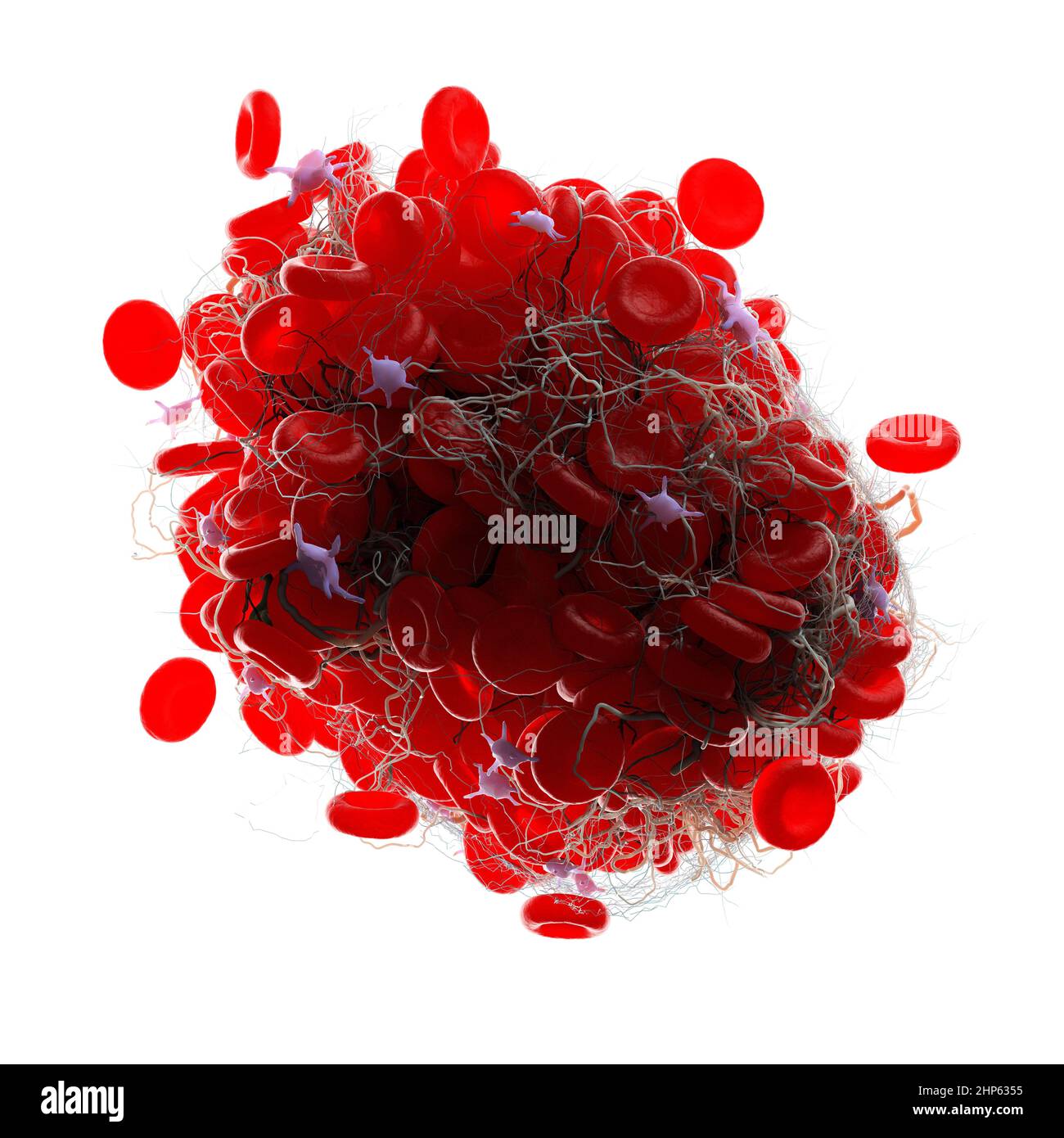 Coagulo di sangue, illustrazione. Foto Stock