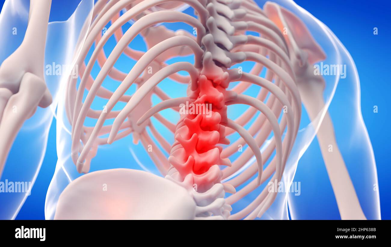 Colonna lombare dolorosa, illustrazione. Foto Stock