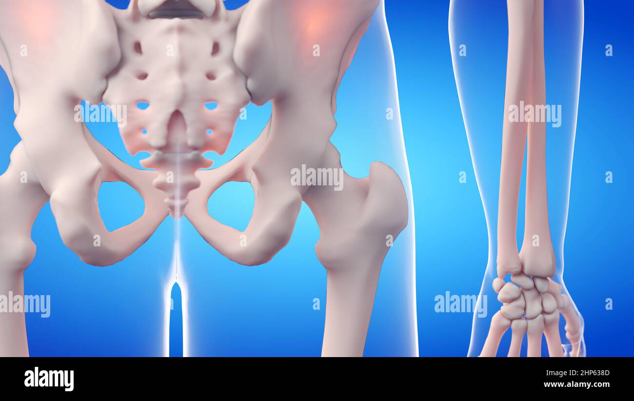 Articolazione dell'anca, illustrazione. Foto Stock