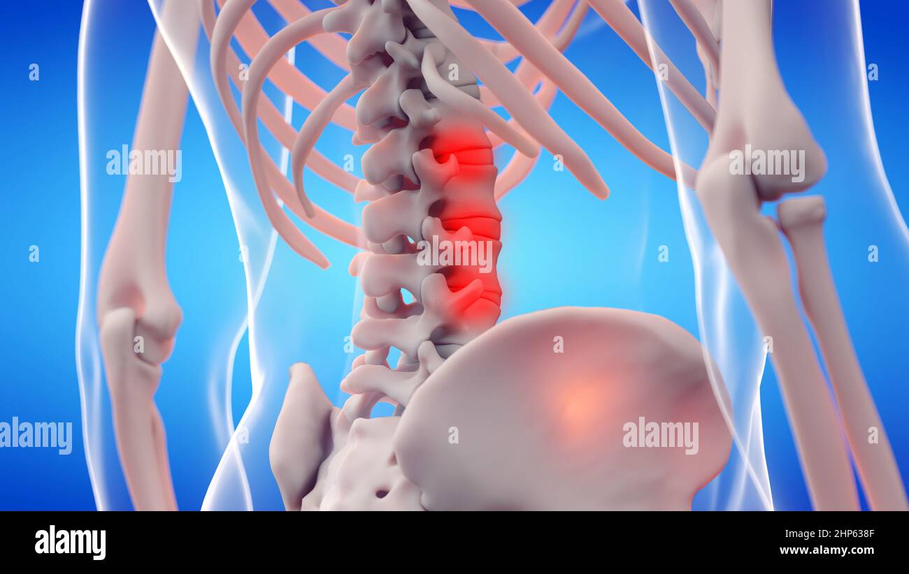 Colonna lombare dolorosa, illustrazione. Foto Stock