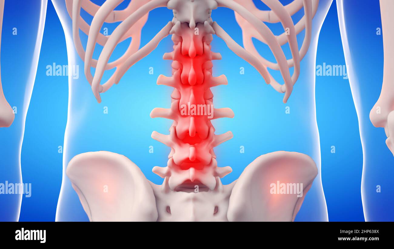 Colonna lombare dolorosa, illustrazione. Foto Stock