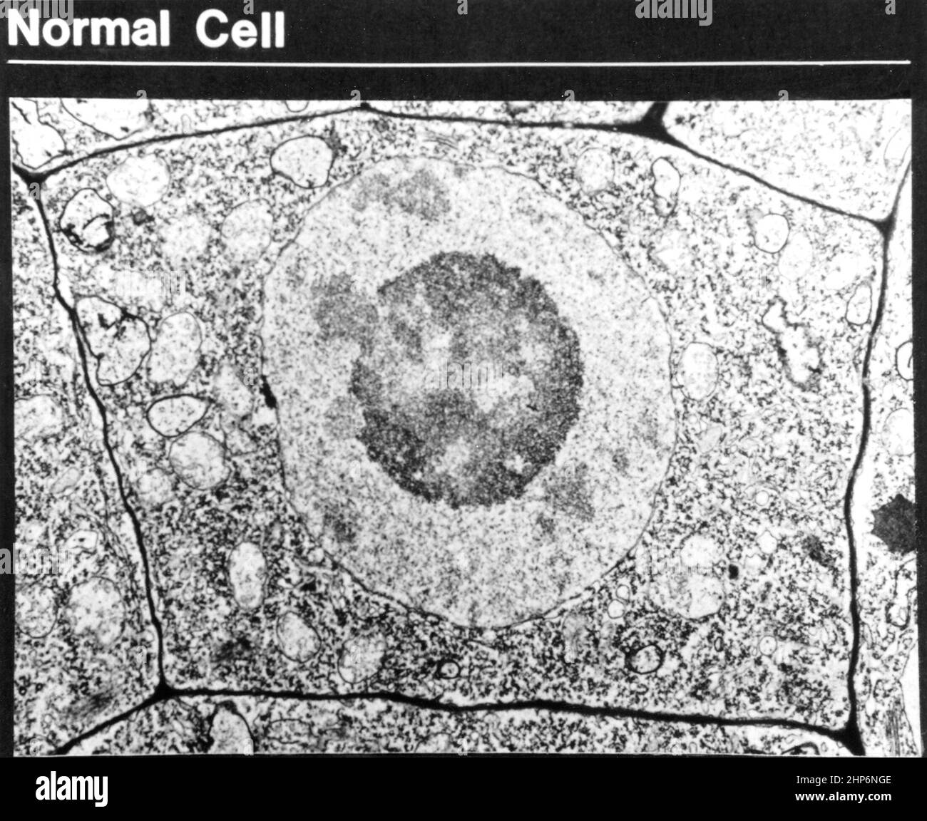 Si tratta di un vetrino istologico di una cellula normale. La membrana cellulare, il nucleo ed il nucleolo sono tutti distinguibili ca. 1985 Foto Stock