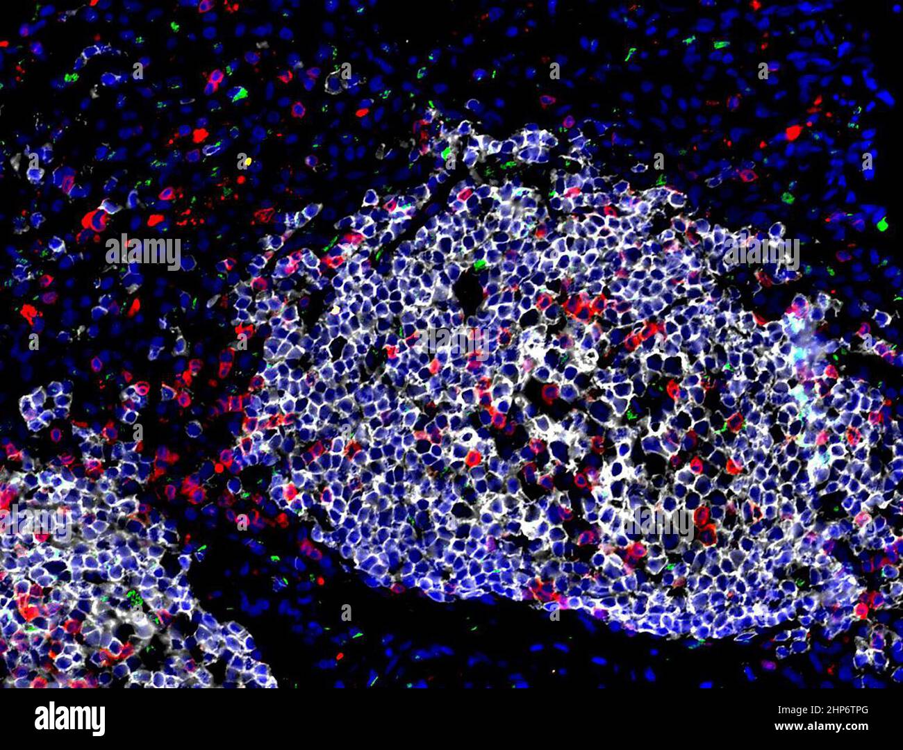 Cellule linfoidi innate immagini e fotografie stock ad alta risoluzione