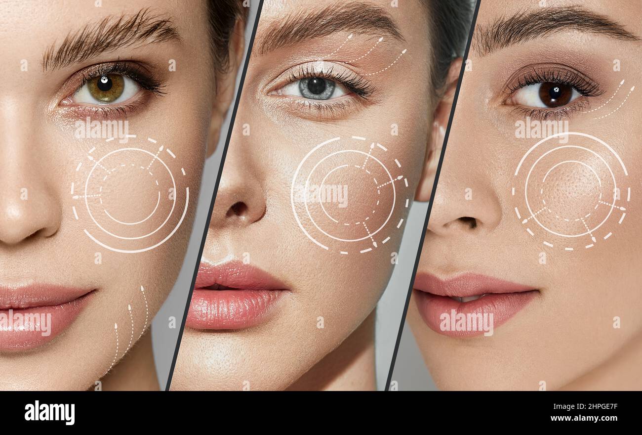 concetto di cura della pelle e ringiovanimento. Set di diversi volti femminili con linee anti-invecchiamento sulla pelle del viso Foto Stock