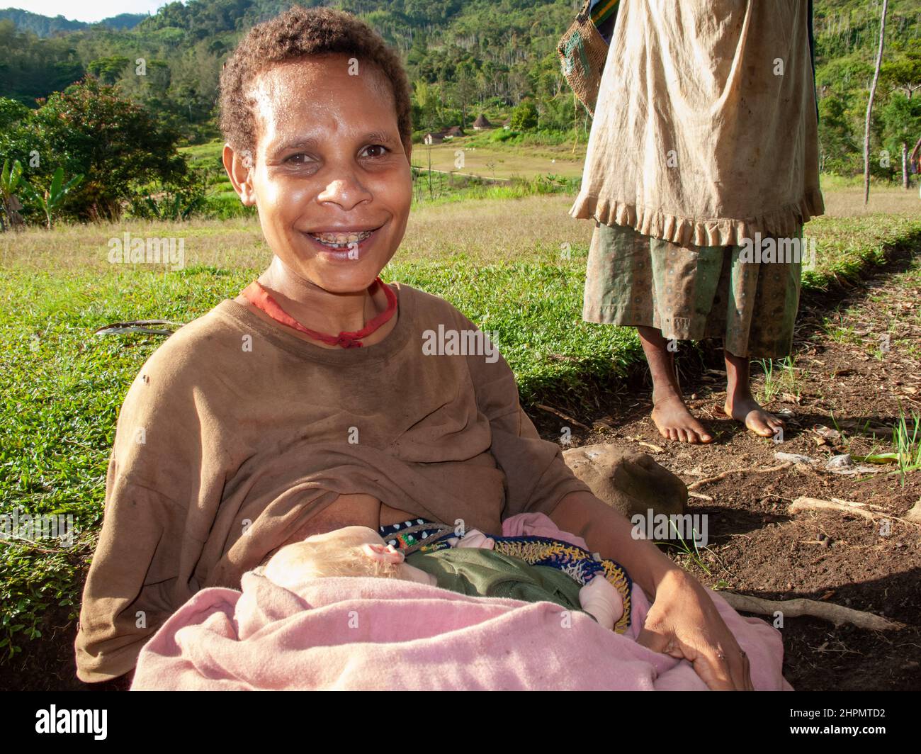 Madre Papuan con il suo neonato. È scura e il suo bambino è albino con capelli bianchi e pelle bianca. Foto Stock
