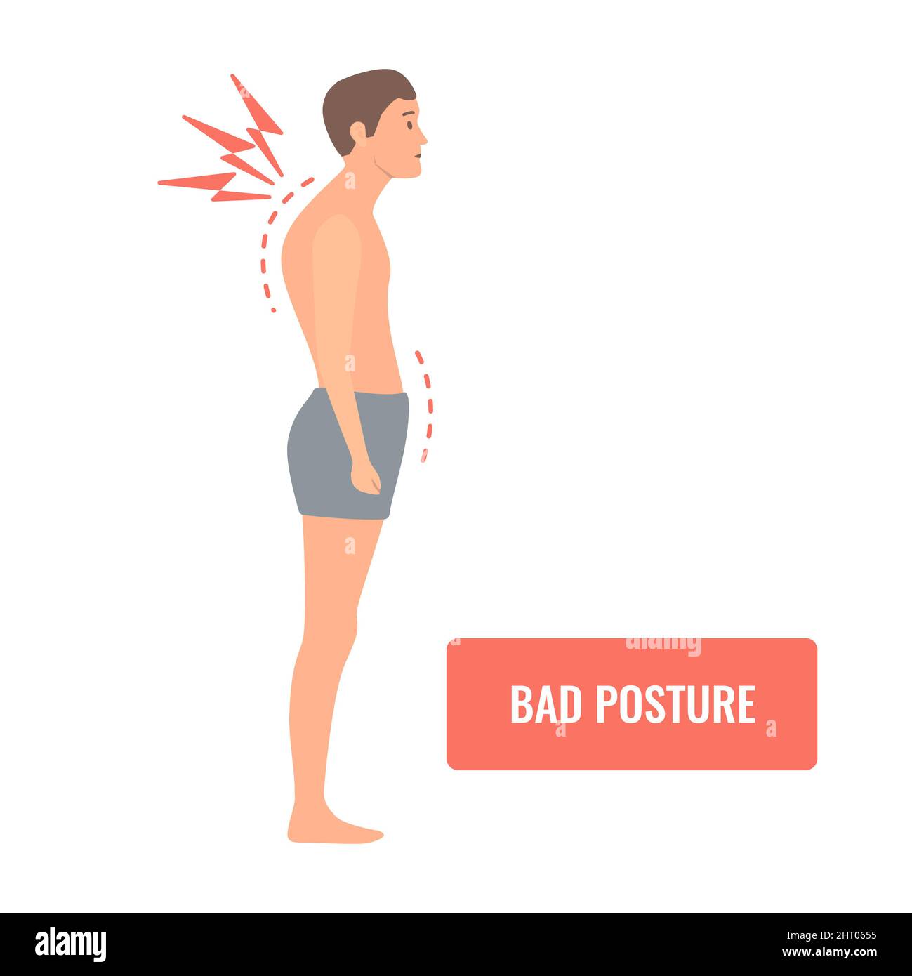 Cattiva postura, illustrazione concettuale Foto Stock