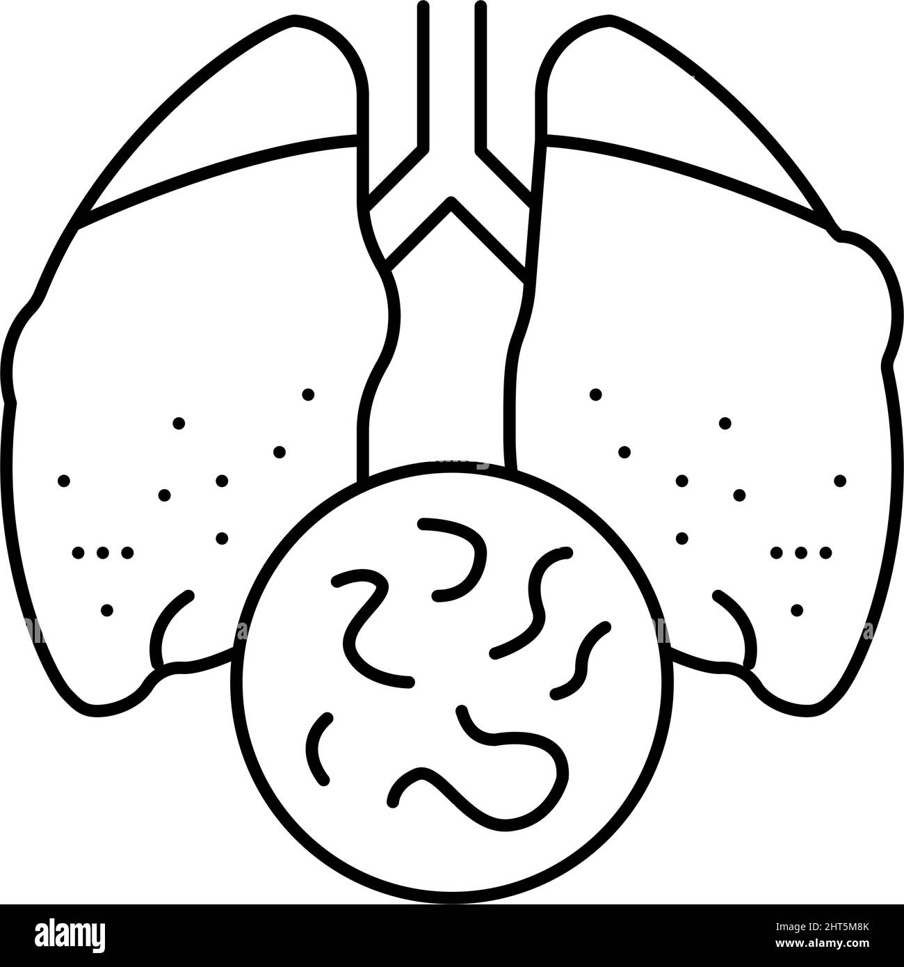 illustrazione vettoriale dell'icona della malattia infettiva tuberculosis Illustrazione Vettoriale