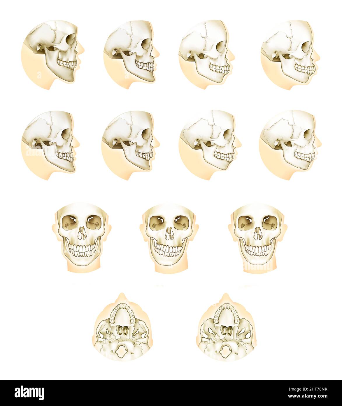 Illustrazione realistica dell'anatomia della chirurgia ortodontica a doppia mandibola Foto Stock