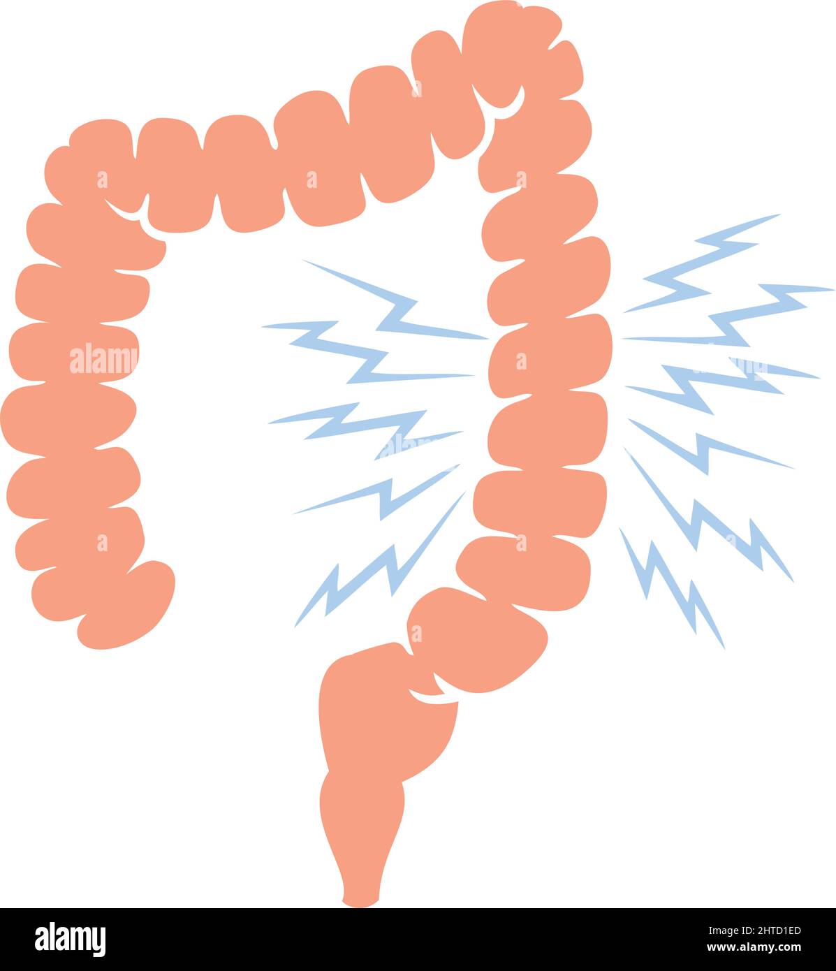 Problema con illustrazione del vettore dell'intestino crasso umano Illustrazione Vettoriale