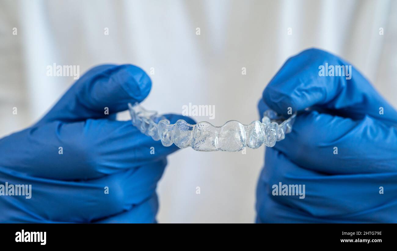 Giovane caucasico che mostra un allineatore invisibile in silicone per la correzione dentale. Mano maschio in guanti che tengono i supporti dentistici di plastica a Foto Stock