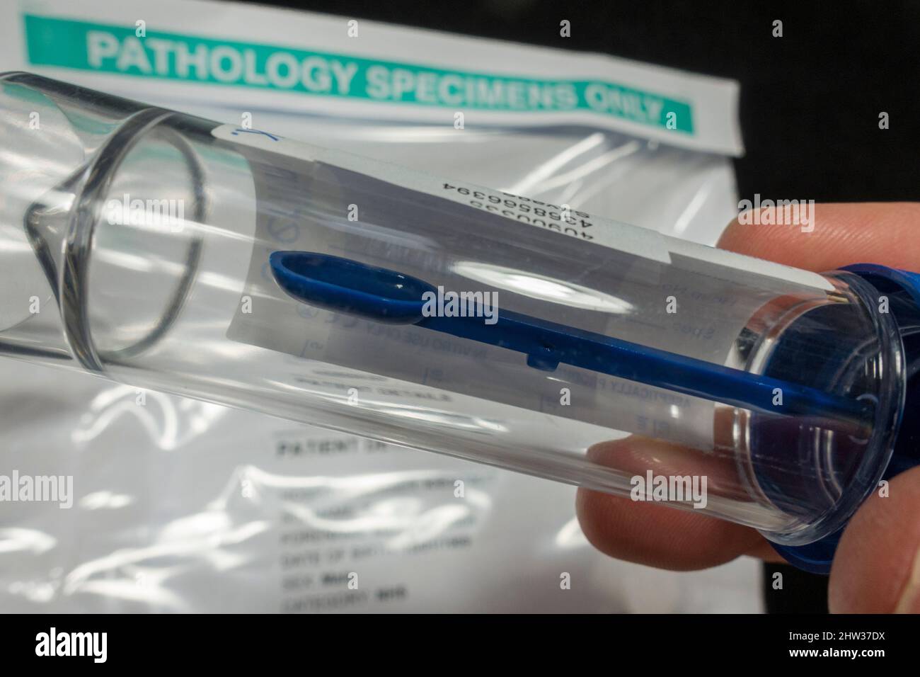 Contenitore per campioni medici con cucchiaio/cucchiaio piccolo per il prelievo di campioni di feci (utilizzato dall'NHS nel Regno Unito per il prelievo di campioni/campioni medici). Foto Stock