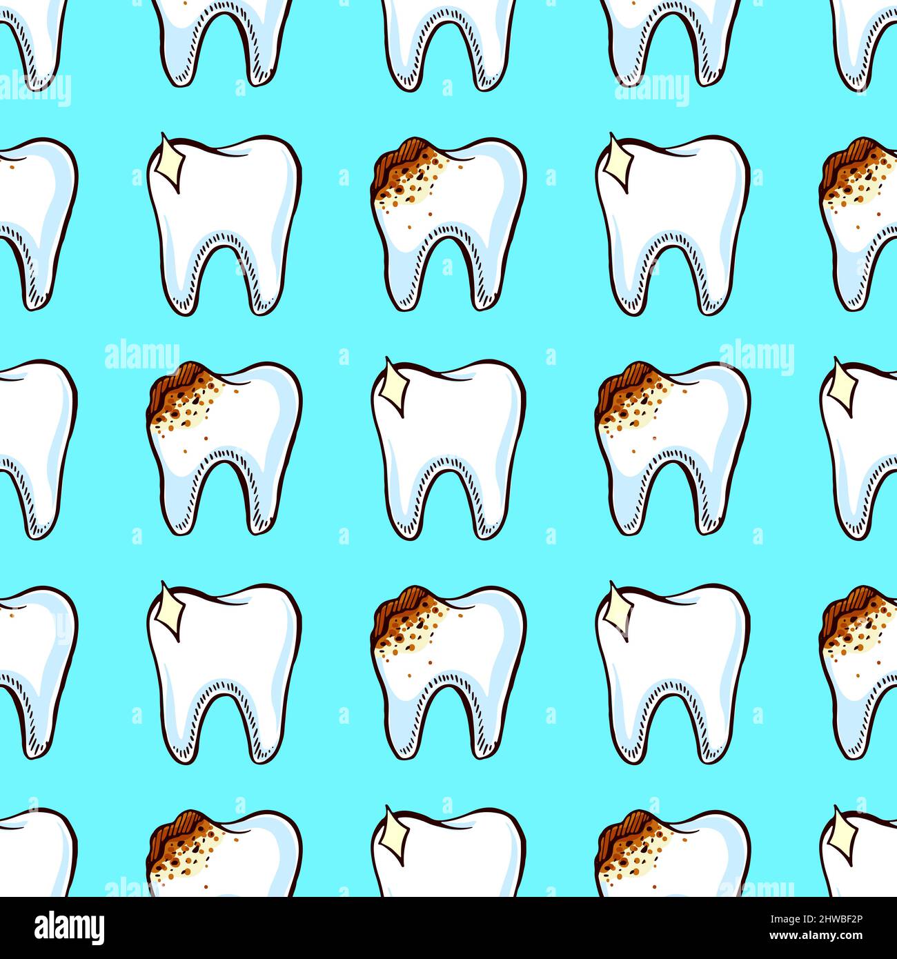 Odontoiatria. Carie. Modello senza giunture con denti sani e cattivi Illustrazione Vettoriale