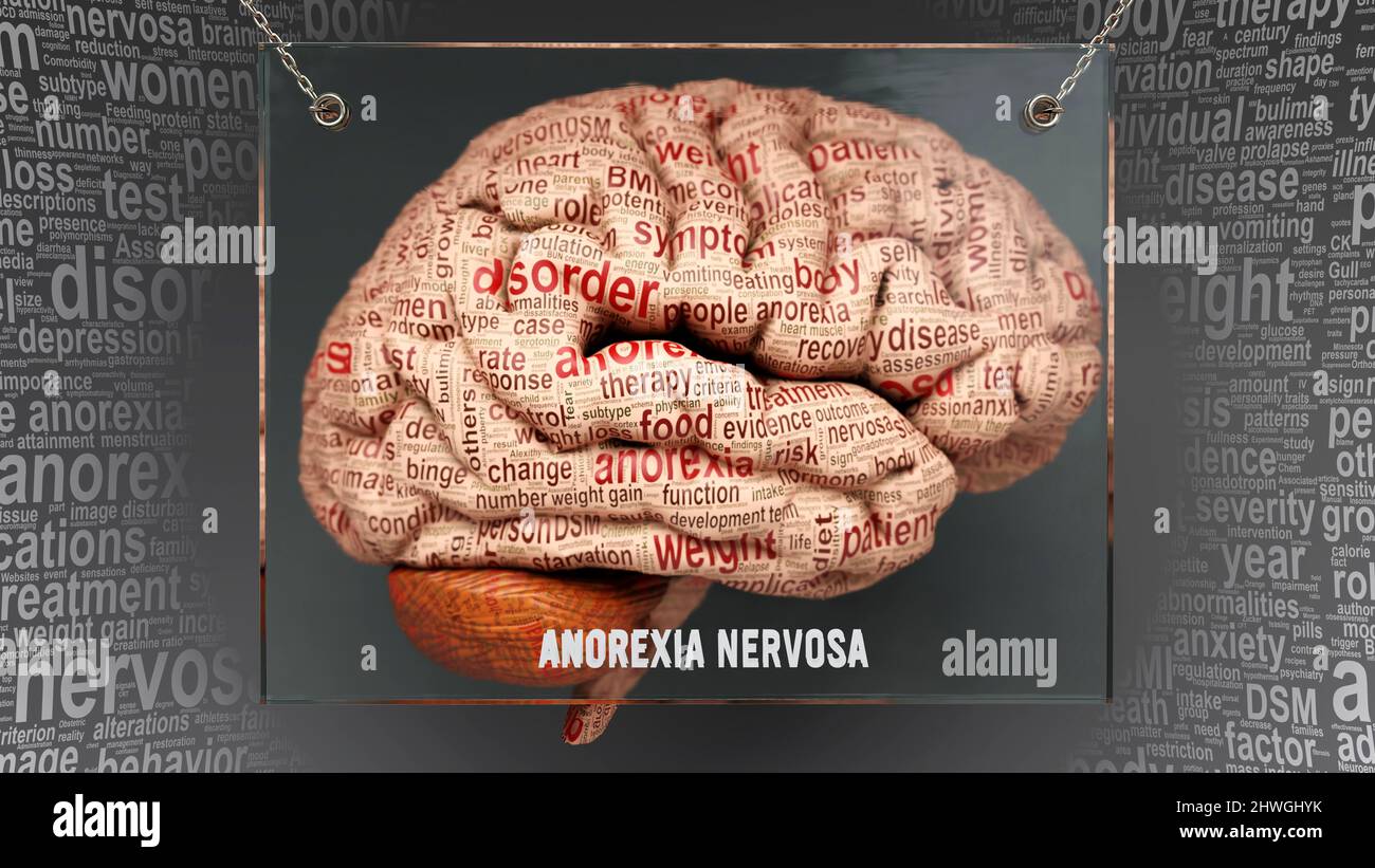 Anoressia nervosa anatomia - le sue cause ed effetti proiettati su un cervello umano rivelando anoressia nervosa complessità e relazione con la mente umana. Concetto Foto Stock