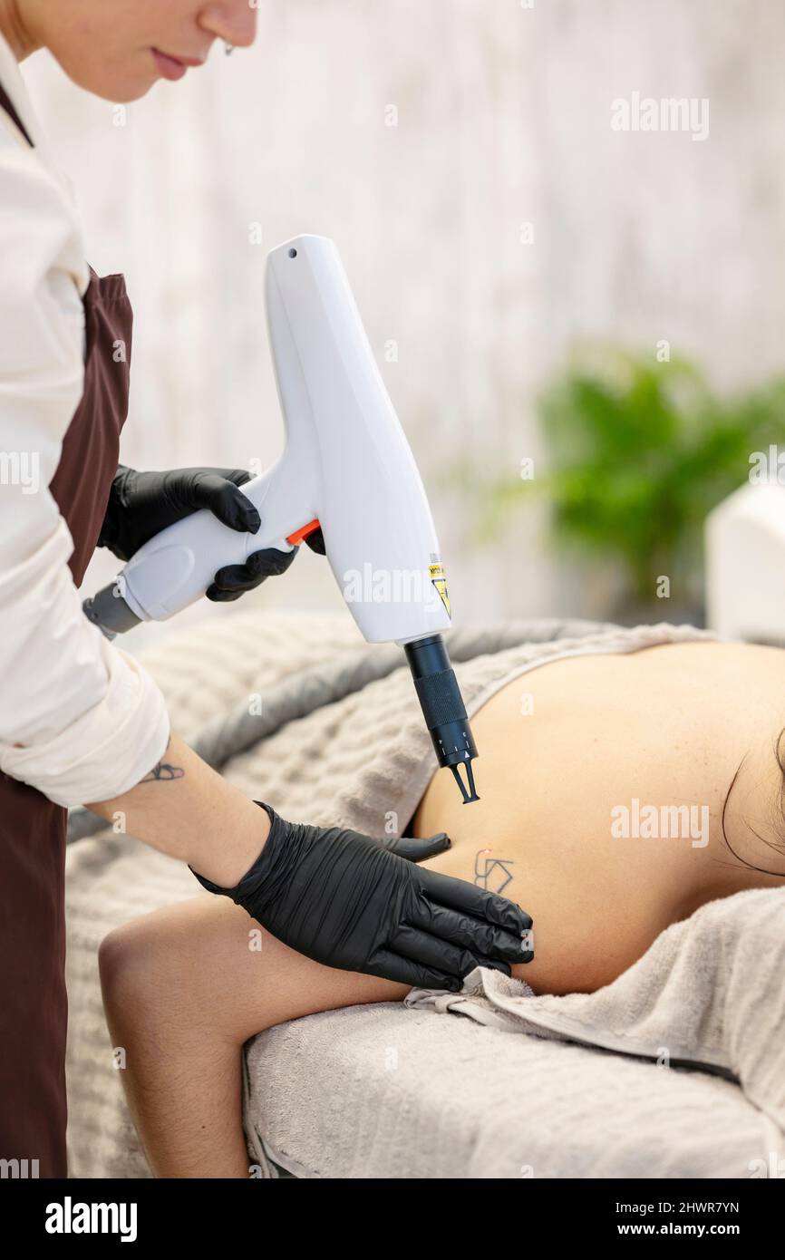 Terapista che rimuove il tatuaggio dalla spalla della donna con laser medico Foto Stock