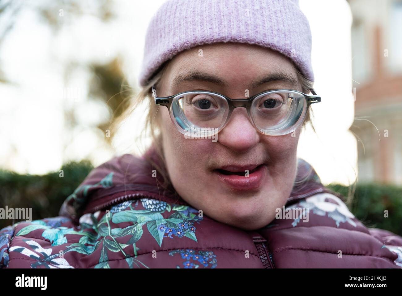 Primo piano ritratto di una donna bianca di 39 anni con sindrome Down Foto Stock