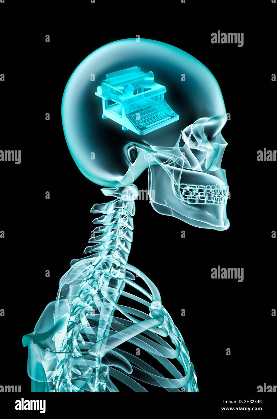 Scrittore autore x-ray concetto - 3D illustrazione di scheletro umano maschile con macchina da scrivere vintage all'interno della testa Foto Stock