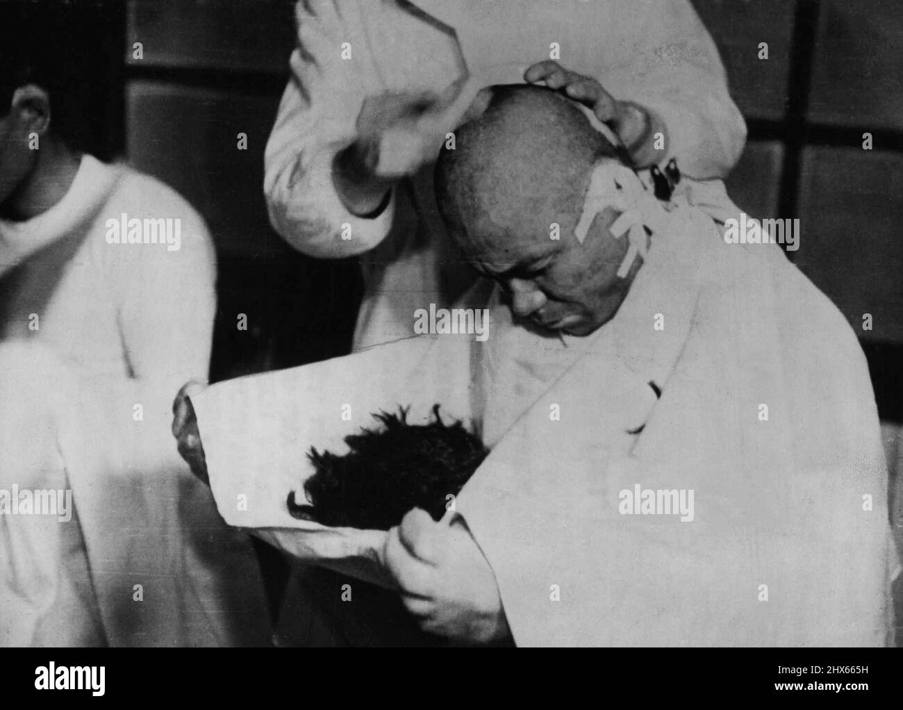 Jap vittime della bomba a idrogeno 'May Still Die' -- uno dei pescatori giapponesi ha i suoi capelli rasati via per ricevere assistenza medica dopo la sua esposizione a radioattivo. I pescatori giapponesi bruciati dalla cenere radioattiva che ha fatto la doccia sulla loro barca dopo il test americano della bomba a idrogeno a Bikini il 1 marzo sono "vivere sulle trasfusioni di sangue" e possono ancora morire, secondo il Dr. Shigevoshi Matsumaye, Un investigatore giapponese. Marzo 26, 1954. (Foto di Paul Popper Ltd.). Foto Stock
