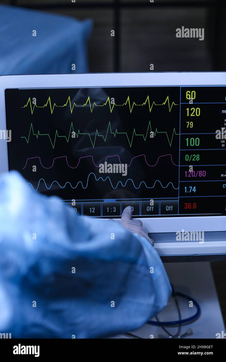 Medico vicino al monitor della frequenza cardiaca moderno in sala operatoria Foto Stock