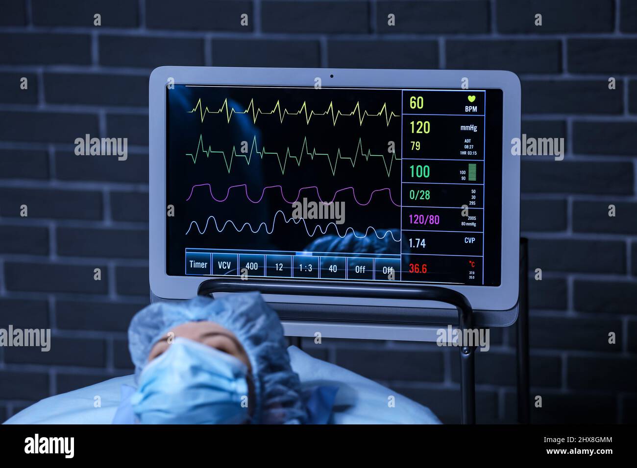 Paziente in prossimità di un moderno cardiofrequenzimetro in sala operatoria Foto Stock
