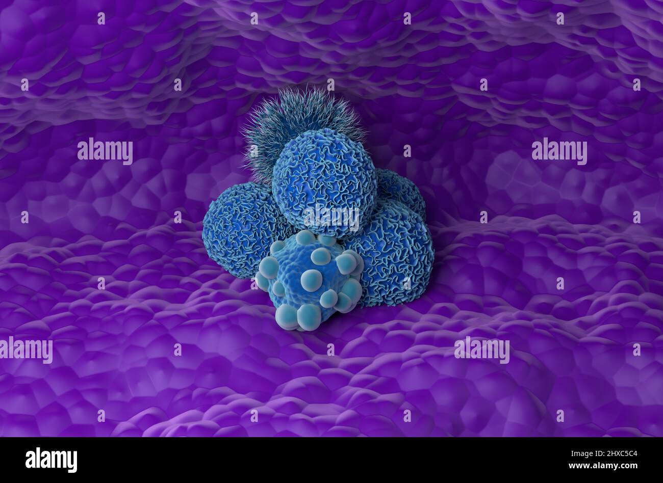 Cellule tumorali pancreatiche - vista isometrica 3D illustrazione Foto Stock