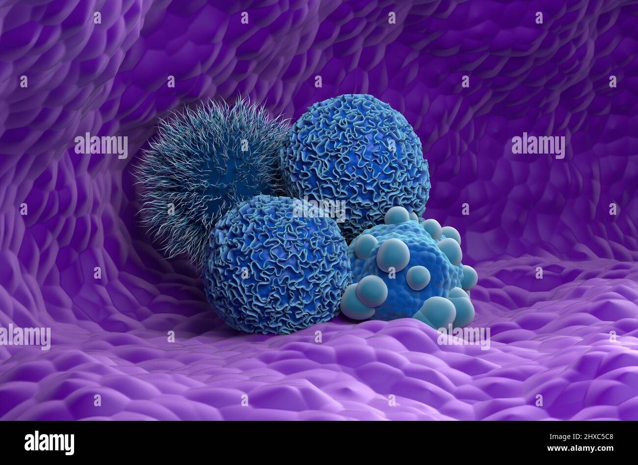 Cellule tumorali pancreatiche - Vista laterale 3D illustrazione Foto Stock