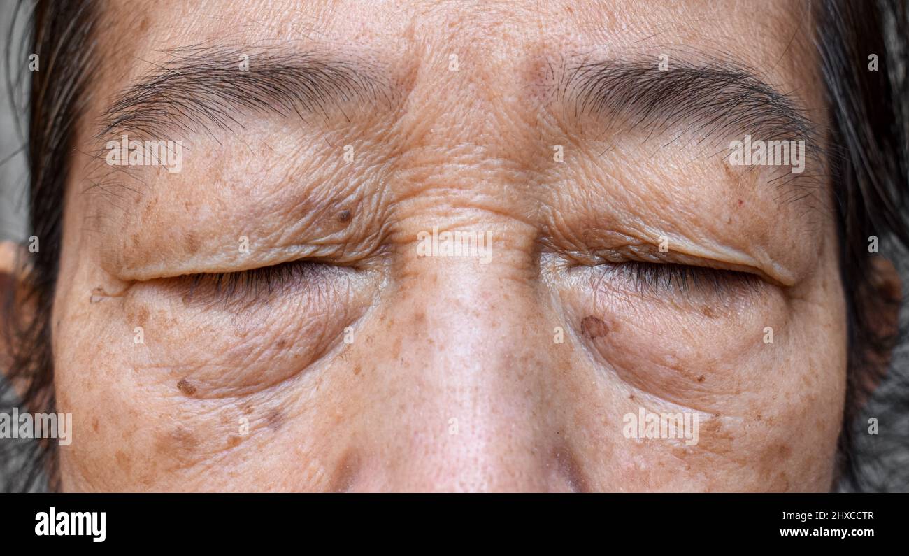 Rughe intorno ad occhio chiuso della donna anziana asiatica. Primo piano. Foto Stock