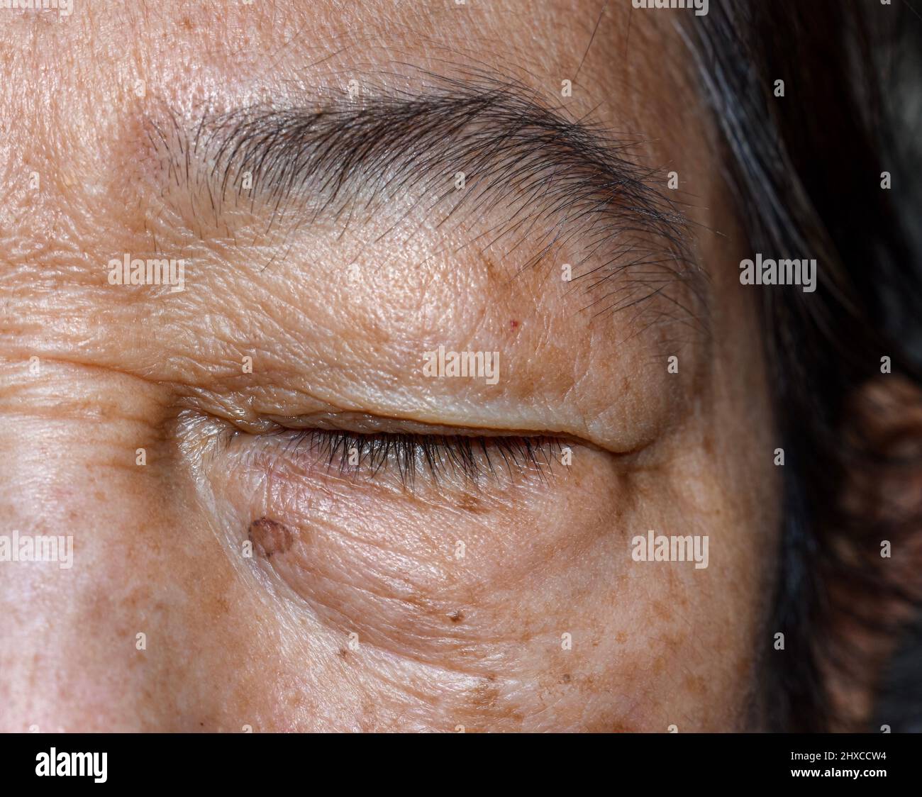 Rughe intorno ad occhio chiuso della donna anziana asiatica. Primo piano. Foto Stock